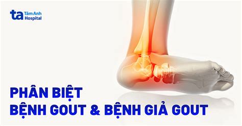 Bệnh Gout Có Dấu Hiệu Gì Tìm Hiểu Triệu Chứng Nguyên Nhân Và Cách