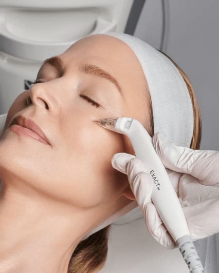 Virtue Rf Microneedling In Ormond Beach Fl Enchanted Ma