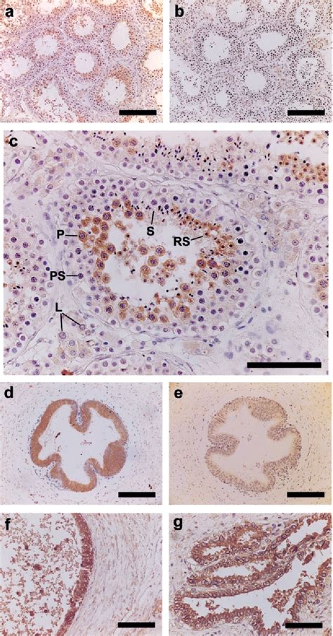 Figure 2 From Prolactin Receptor Expression In Human Testis And