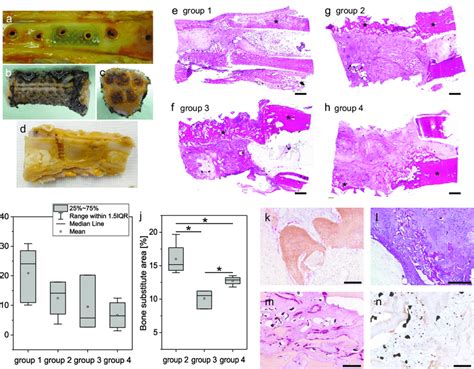 Histological And Immunohistological Analysis Of The Newly Formed Bone