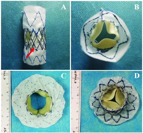 Introduction To The Configuration Of Aortic Valved Fenestrated Stent Download Scientific