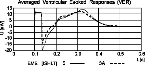 Figure 1 From Computerized Heart Rejection Monitoring Using High