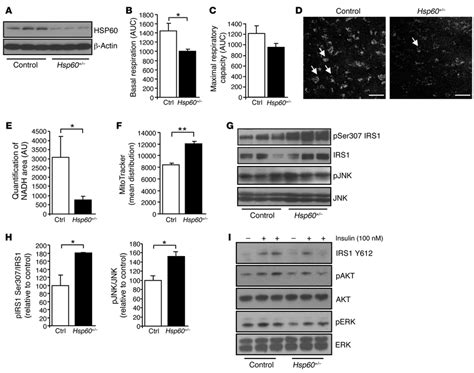 Hsp60 Mice Suffer From Mitochondrial Dysfunction And Insulin