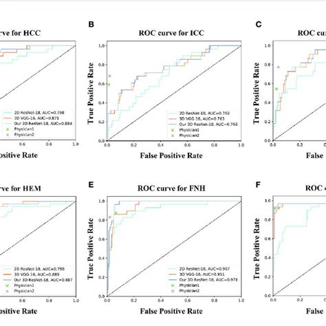 Roc Curves Of Different Networks For Binary Classification The