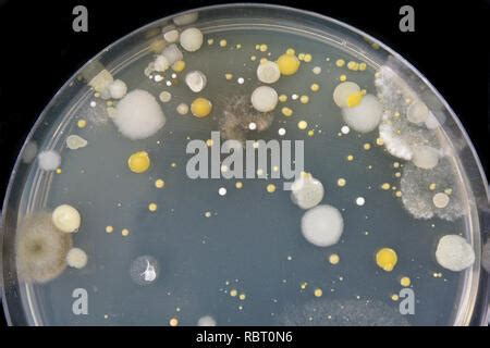 Growth Of Microorganisms In A Petri Dish Bacteria Yeast And Mold