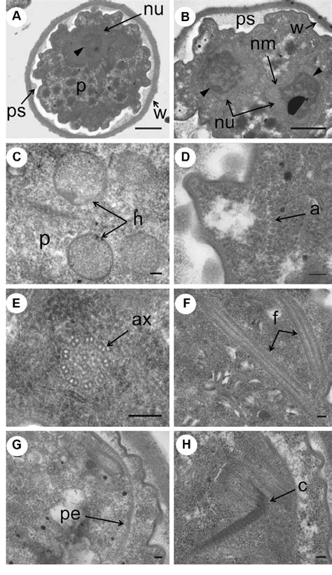 Figure 3 From Cyst Formation And Faecal Oral Transmission Of Dientamoeba Fragilis The Missing