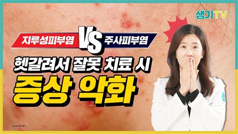 주사피부염 Vs 지루성피부염 치료 방법과 발생원인 Youtube