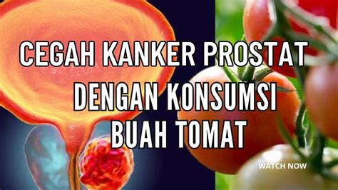 Cegah Kanker Prostat Dengan Konsumsi Buah Tomat Info Sehat Perlu