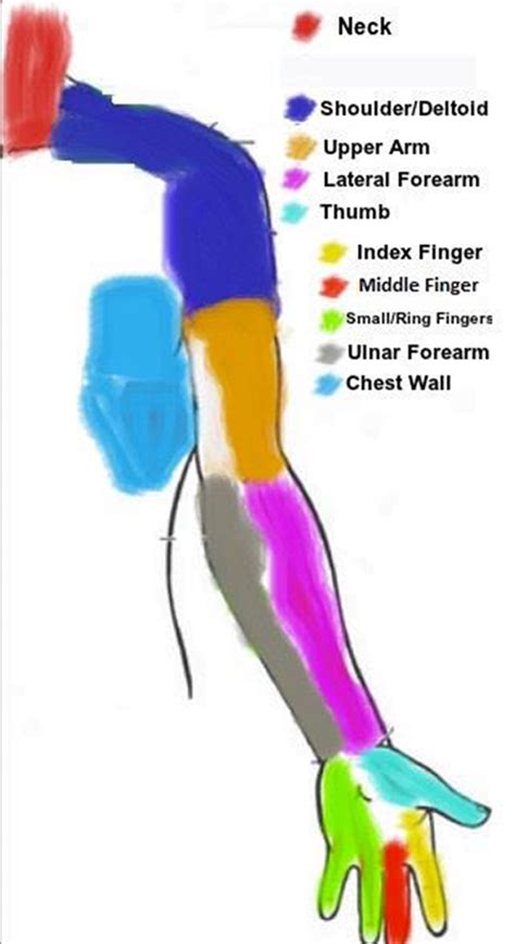 Cervical Radiculopathy Dermatome Distribution Porn Sex Picture