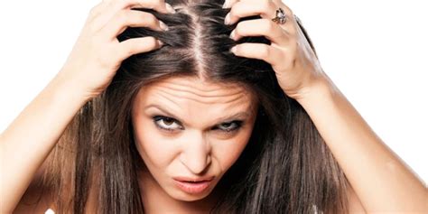 How To Get Rid Of Dandruff Forever Natural Ways To Get Rid Of