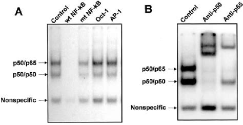 Figure 2 From Role Of High GlucoseInduced Nuclear Factor B Activation