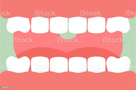 Ouvrir La Bouche Avec Des Dents Saines Et De Langue De Soins Dentaires