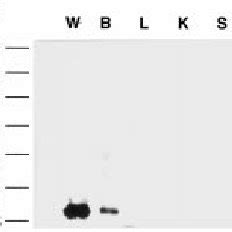 Western Blot Analysis Of Microsomal Fractions From Each Mouse Tissue