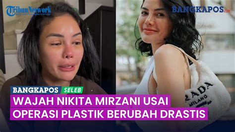 Wajah Nikita Mirzani Usai Operasi Plastik Berubah Drastis Warganet