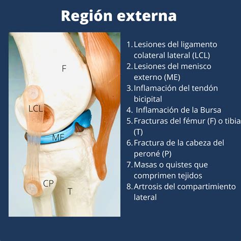 Lista 95 Foto Imágenes De Tumor En La Rodilla El último