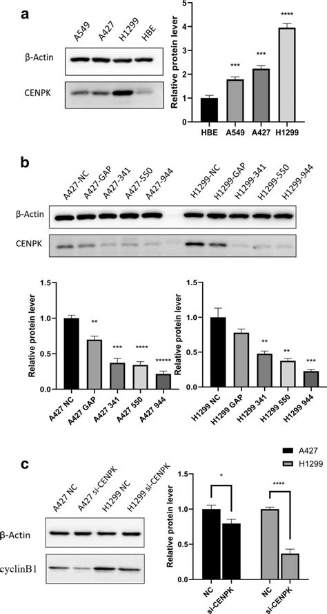 In Vitro Verification Of The Expression Of Cenpk And Related Pathways