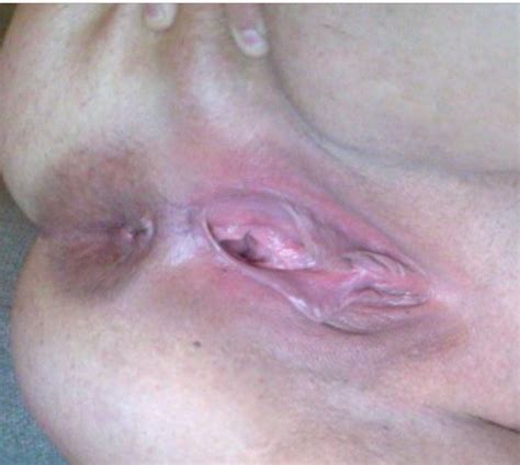 Face Skin Nose Cheek Close Up Porn Pic