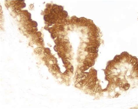 Vector Lab代理DAB Substrate Kit Peroxidase HRP with Nickel 3 3