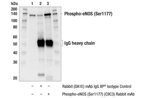 Phospho Enos Ser1177 C9c3 Rabbit Mab Cell Signaling Technology