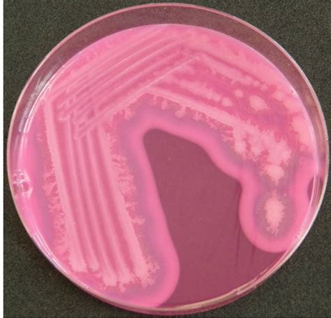 Bacillus Cereus Agar Base Scheda Del Terreno Di Coltura Per Microbiologia