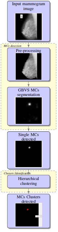 Flowchart Of The Proposed Microcalcifications Clusters Segmentation Download Scientific Diagram