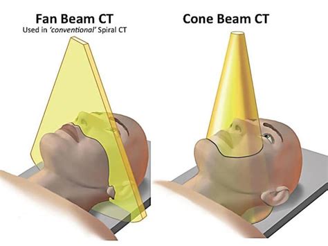 What Is Cone Beam Ct And How Does It Work The Best Picture Of Beam