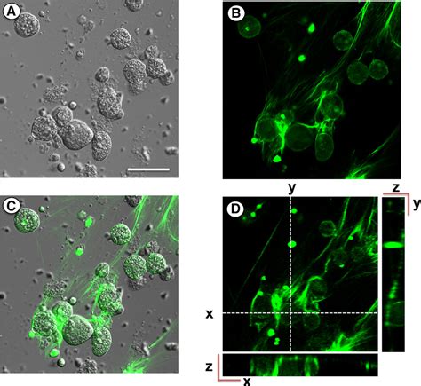 Pathogenic Entamoeba Histolytica But Not Entamoeba Dispar Induce Neutrophil Extracellular Trap