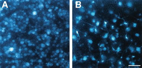 Retrogradely Labeled Rgcs Of Mice With Uninjured And Injured Optic