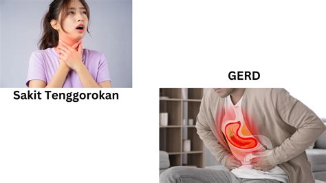 Perbedaan Antara Gastroesophageal Reflux Disease GERD Dan Radang