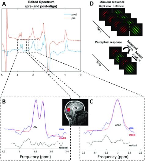 Example Magnetic Resonance Spectroscopy Spectrum And Stimulus Sequence