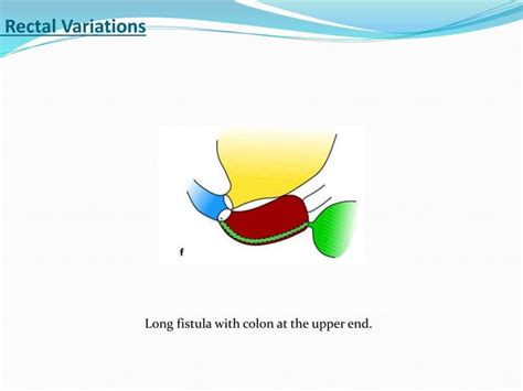 Cloaca approach to decision making | PPT