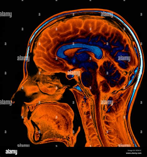 Sezione Sagittale Del Cervello Umano Immagini E Fotografie Stock Ad