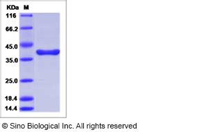 Recombinant Human Arginase 1 ARG1 Protein 11558 H35H Sino Biological