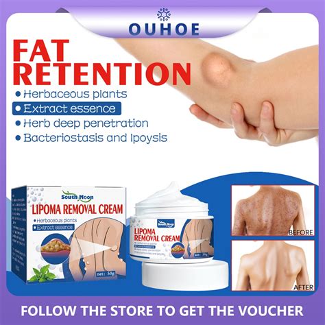 【buy 2 Get 1】50g Lipoma Removal Cream Lipolysis Fat Lump Relief Plaster