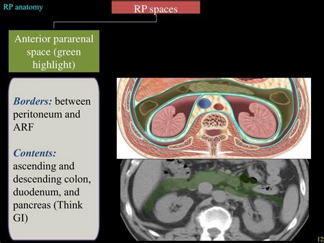 Ppt Overview Of Retroperitoneal Anatomy Masses And Disease Spread