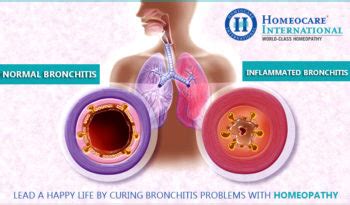 Allergic Bronchitis | Homeocare International