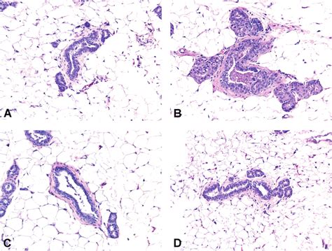 Mammary Gland From Female F344 Rats Given Vehicle A The Serm