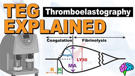 Teg Explained Understanding The Thromboelastography Youtube