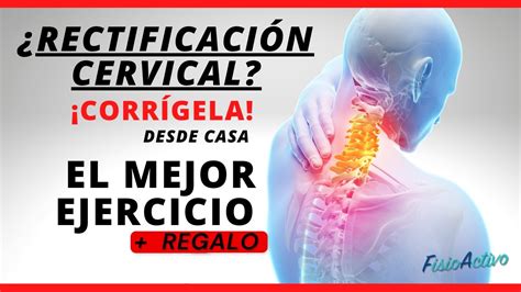 Este Es El Mejor Ejercicio Para Tratar La Rectificaci N Cervical