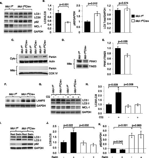 Loss Of MCL 1 Leads To Impaired Autophagy And Rapid Development Of