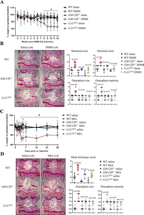 The GM CSF CCL17 Pathway In Obesity Associated Osteoarthritic Pain And