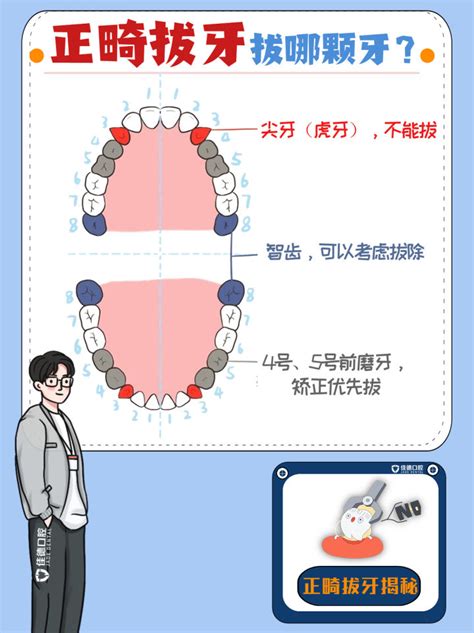 合肥牙齿矫正医院：正畸拔牙：拔哪颗牙？拔智齿吗？真相来了 哔哩哔哩