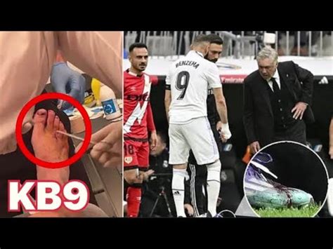 Karim Benzema A Jou Avec Une Blessure Lors De La Victoire Avec Rayo