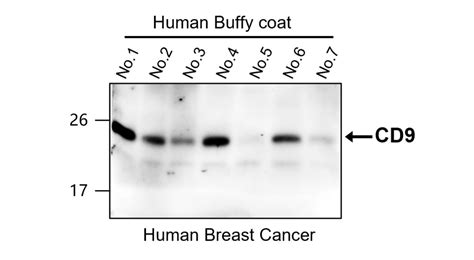 Exosome Marker Antibody Panel Irap Ireal Biotechnology Inc