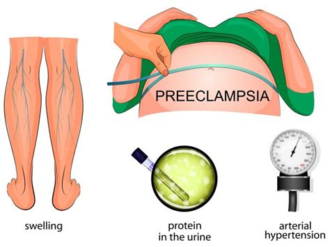 Preeclampsia Diagnosis And Treatments Organic Facts