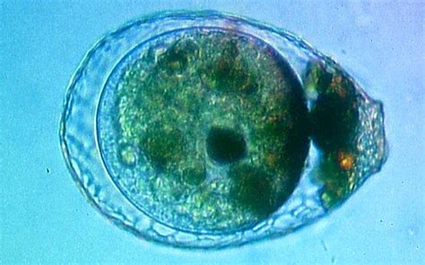 Amoebozoa: qué es, características, morfología, nutrición