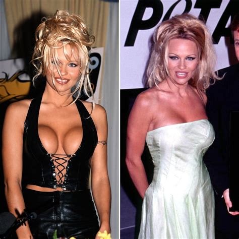 Celebs Who Had Breast Implants Removed Before After Photos Life And Style