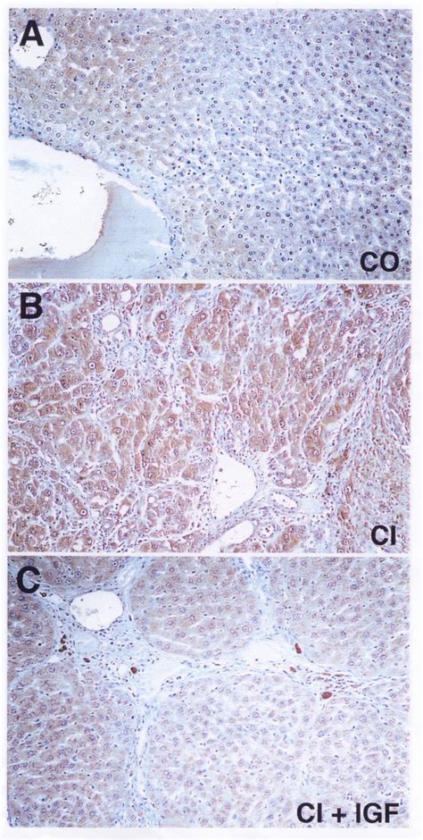 Immunostaining For INOS In Liver From A Healthy Control Group CO