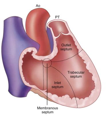 Ventricular septum anatomy - wikidoc