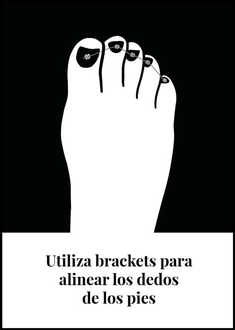 Brackets En Los Pies Club De Escritura Fuentetaja